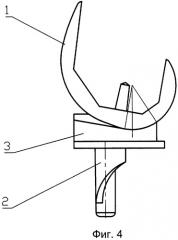 Эндопротез коленного сустава (патент 2271175)