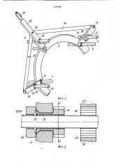 Устройство для лечения переломов костей (патент 1076108)