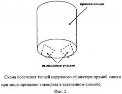 Способ создания модели энкопреза (патент 2518127)