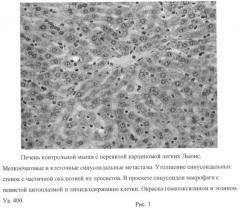 N-[3-оксо-лупано-28-ил]-пиперидин-средство с противоопухолевой, антиметастатической, противовоспалительной и цитопротекторной активностью (патент 2466136)