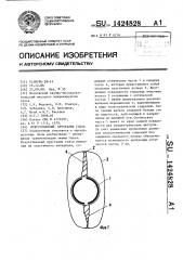 Искусственный хрусталик глаза (патент 1424828)