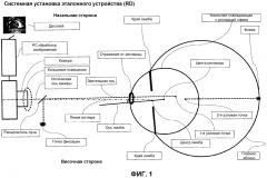 Устройство для мониторинга одного или более параметров глаза (патент 2600855)