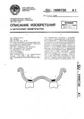 Съемный пластиночный протез (патент 1600750)