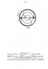 Якорное устройство (патент 1466981)