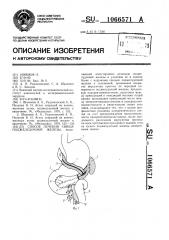 Способ лечения свища поджелудочной железы (патент 1066571)