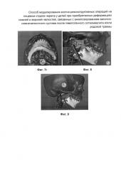 Способ моделирования костно-реконструктивных операций на лицевом отделе черепа у детей при приобретенных деформациях нижней и верхней челюстей, связанных с анкилозированием височно-нижнечелюстного сустава после гематогенного остеомиелита и/или родовой травмы (патент 2604774)