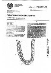 Внутренняя смягчающая вкладная гильза протеза нижней конечности (патент 1739990)