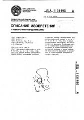 Способ лечения врожденного вывиха бедра (патент 1131495)