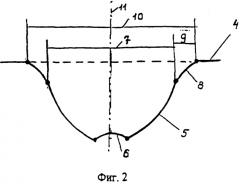 Способ хирургической коррекции пресбиопии в сочетании со сложным миопическим астигматизмом (патент 2314080)