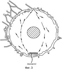 Внутрикамерные имплантаты с пролонгированным высвобождением терапевтического агента (патент 2565445)