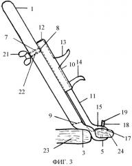 Хирургический инструмент (патент 2393793)