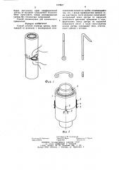 Способ лечения стриктур уретры (патент 1273077)