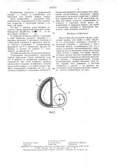 Искусственный желудочек сердца (патент 1537241)