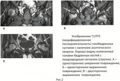 Скрининговый способ диагностики асептического некроза суставных концов костей крупных суставов (патент 2436512)