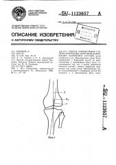 Способ определения степени коррекции варусной деформации коленного сустава (патент 1123657)