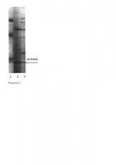 Штамм бактерий escherichia coli bl21 (de3) bpsompa-продуцент рекомбинантной плазмидной днк pbpsompa, несущей полноразмерную последовательность гена поверхностного протеина ompa/motb burkholderia pseudomallei (патент 2662958)