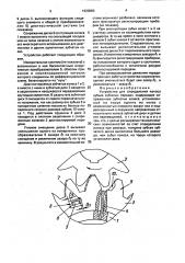 Устройство для определения износа зубьев зубчатых передач (патент 1620880)