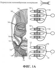 Система и способ стимуляции лицевого нерва (патент 2511082)