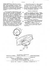 Протез слуховых косточек (патент 993934)