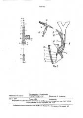 Устройство для диагностического зондирования желчных протоков (патент 1648491)