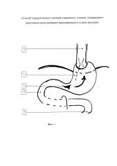 Способ хирургического лечения вторичного стеноза пищеводного анастомоза после резекции проксимального отдела желудка (патент 2657192)