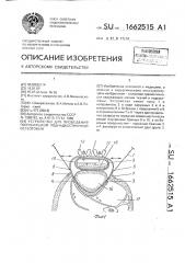 Устройство для проведения полузакрытой поднадкостничной остеотомии (патент 1662515)