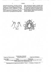 Ортодонтический аппарат для расширения верхней челюсти (патент 1736463)