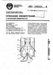Топка (патент 1035331)