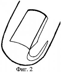 Способ лечения вросшего ногтя первого пальца стопы (патент 2282407)