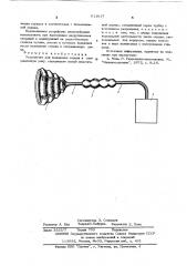 Устройство для выведения сердца в операционную рану (патент 611617)