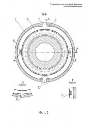 Устройство для окружной фиксации подшипника качения (патент 2655573)