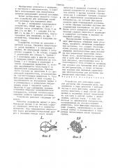 Устройство для репозиции краев ран роговицы при наложении швов (патент 1306576)