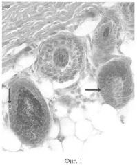 Дерматологическое и/или косметологическое средство, стимулирующее рост волос, средство, влияющее на размножение клеток волосяных фолликулов (патент 2357722)