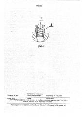 Устройство для соединения вала рабочего валка с валом шестеренной клети прокатного стана (патент 1755985)