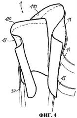 Приемная гильза протеза и система из приемной гильзы протеза и протезного устройства (патент 2476190)