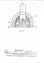 Стоматологический имплантат (патент 1814889)
