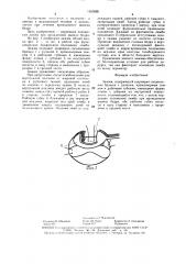 Зажим (патент 1553080)