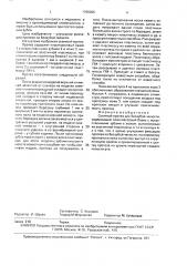 Съемный протез для беззубой челюсти (патент 1706605)