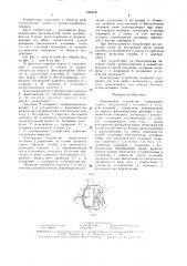 Электродное устройство (патент 1502030)