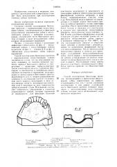 Способ изготовления бюгельных протезов (патент 1505531)