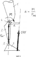 Способ и устройство для управления ортезом или протезом сустава нижней конечности (патент 2572741)