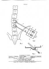 Устройство для коррекции позвоночника (патент 973119)