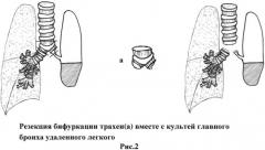Способ хирургического лечения бронхоплеврального свища, возникшего после полного удаления легкого (патент 2558455)