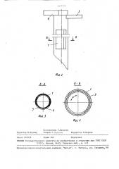Эзофагоскоп (патент 1477375)