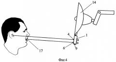 Лазерный параллелометр для построения протетической плоскости (патент 2360643)