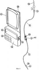 Инфузионный насос (патент 2325927)