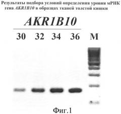 Способ диагностики рака толстой кишки и набор для его осуществления (патент 2374647)