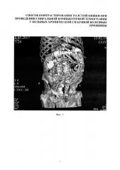Способ контрастирования толстой кишки при проведении спиральной компьютерной томографии у больных хронической спаечной болезнью брюшины (патент 2666120)