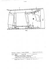Устройство для крепления груди забоя (патент 750099)