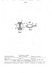 Устройство для лечения копытца животного (патент 1576111)